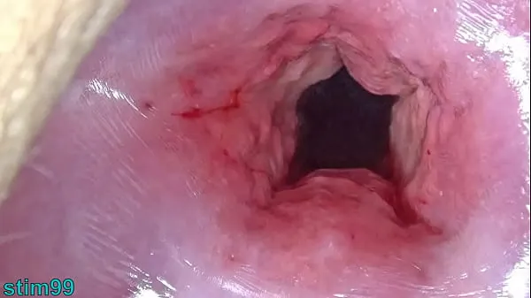 Mostra Mamma giapponese Cervice spalanca la dilatazione e scopa l'utero con l'inserimento di oggetti enorminuovi video